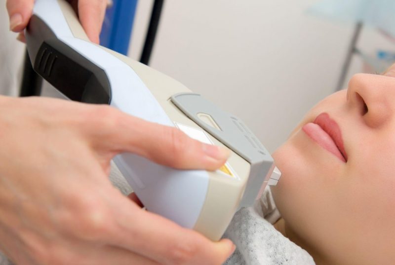 Laser-Hair-Removal-1024×689 Laser-Hair-Removal-1024x689